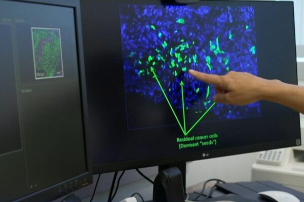 Scientists seek to wipe out breast cancer's "sleeper cells"