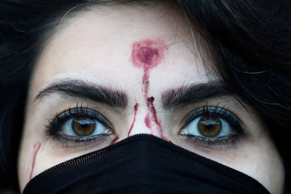 A woman with a mock-up of a gunshot bullet wound on her forehead looks on during a rally in Rome