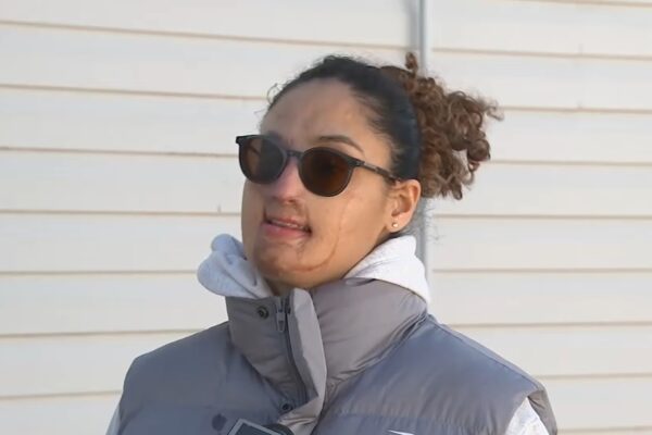 Long Island acid attack arrest: Arrest made years after young woman assaulted in Elmont, Nassau County in 2021