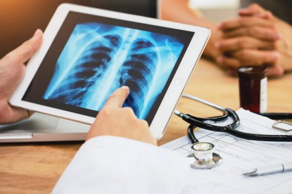 Patients given more hope as study finds best time for lung cancer treatment