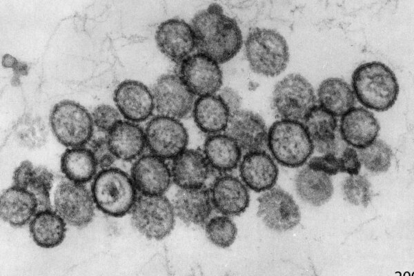 Hong Kong seeks more details from WHO on hantavirus outbreak on cruise ship