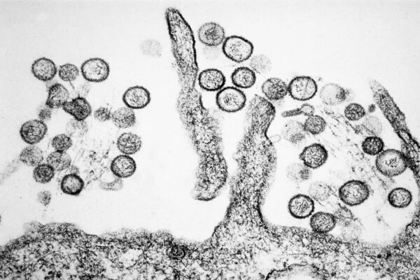 A microscope image of Hantavirus. Photo: Cynthia Goldsmith, USCDCP.