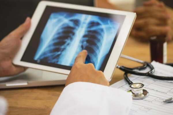 Targeted therapy could turn advanced lung cancer into chronic illness: CUHK study