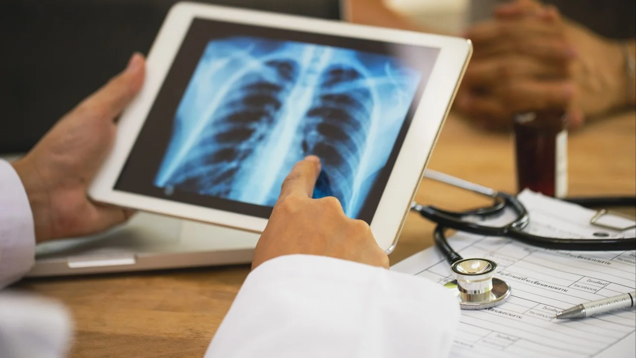 Targeted therapy could turn advanced lung cancer into chronic illness: CUHK study