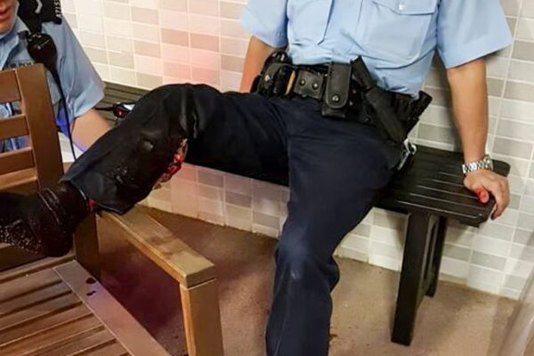 A policeman was bitten in the right calf by a wild boar in November 2021. Photo: FACEBOOK.