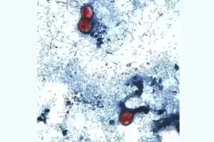 Nearly 1,000 cyclospora cases reported in Michigan in largest-ever parasite outbreak